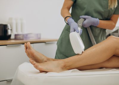 Laser Treatment Zara Toronto legs and feet
