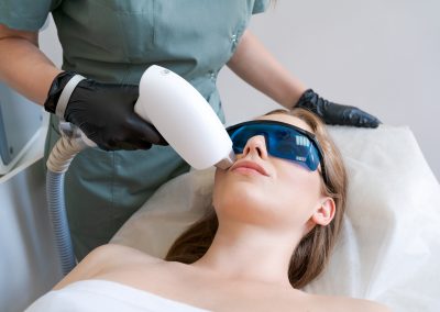 Laser Treatment Zara Toronto face